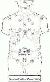 List Of Hijama Points Cupping Therapy Pictures And Hijama