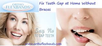 Teeth that are misaligned or crowded, teeth that have large gaps between them, and jawlines. Fix Teeth Gap At Home Without Braces Www Orthoflexbands Com Fix Teeth Gap