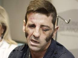 Das Gesicht des Toreros Juan Jose Padilla ist schwer gezeichnet durch einen Unfall: Sein Gesicht wurde vom Horn eines Stiers durchbohrt, trotzdem will er ... - Juan-Jose-Padilla