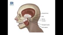 TMD (Temporomandibular Disorders) | National Institute of ...