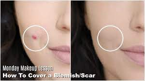 how to cover acne scars blemishes