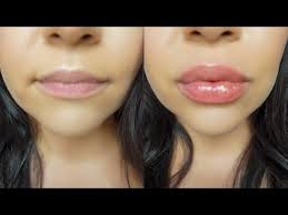 huge lips without injections
