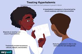 treating hyperkalemia