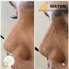 mayon aesthetic centre dental skin
