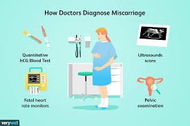 how doctors diagnose miscarriage