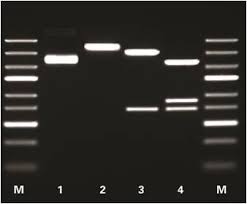 Fastdigest Restriction Enzymes Thermo Scientific Thermo