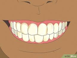 Found from the krazy coupon lady. 3 Ways To Fix Nicotine Stained Teeth Wikihow