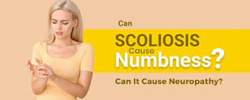 can scoliosis cause numbness can it