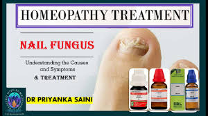 nail fungus toenail fungus
