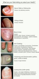 Nail Disorders A Visual Reference Table Foamed In 2019