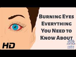 burning eyes everything you need to