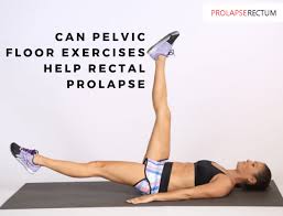 pelvic floor exercises help rectal prolapse