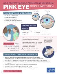 preventing pink eye conjunctivitis