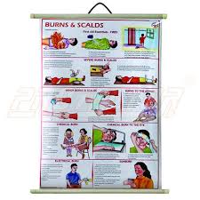 Safety Chart For Burns And Scalds Eng