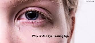 crying from one eye causes and treatment