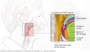 There are different structures and areas within the throat and they have different names. Throat Cancer Symptoms And Causes Mayo Clinic