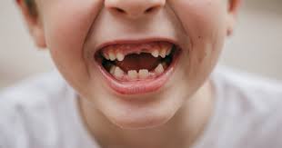 Wondering how to pull a tooth out at home? Losing Baby Teeth When Do They Fall Out And In What Order Care Com