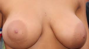 File:Breasts with large areolas.jpg 