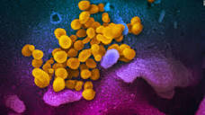 Coronavirus news: the latest on the global pandemic - CNN
