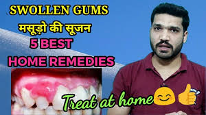 remes for swollen gums