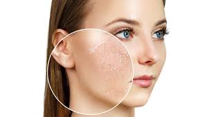 expert dermatologist tips for dry skin