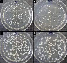 bacterial colonies grown on agar plates