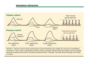 Alternative Modes Of Mechanical Ventilation A Review For