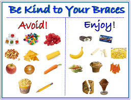 Be Kind To Your Braces Chart Foods To Avoid Enjoy When You