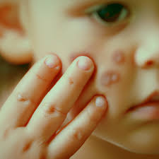 skin conditions in children types