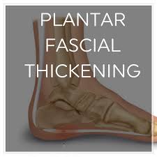 plantar fascial thickening prevention