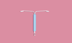 7 side effects to prepare for before you get the mirena iud