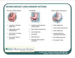Weight Loss Surgery Comparison Chart Www Bedowntowndaytona Com