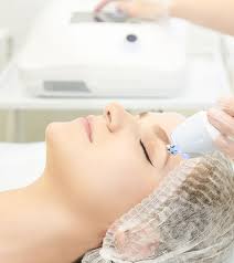 microdermabrasion benefits and