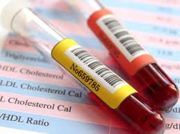 lipid panel cholesterol test ranges