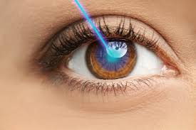 People i'm also interested to know how someone could get diplopia from lasik. The Top Laser Eye Surgery Faq Are You Awake During Lasik Surgery Adv Vision Centers