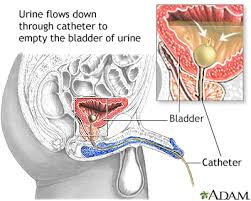 traumatic injury of the bladder and