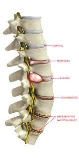 Regenerative Spine And Joint gambar png
