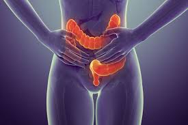 colon cancer symptoms signs and