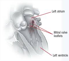 Many people with a mitral valve prolapse do not have symptoms and it may only be spotted during a heart scan. Managing Mitral Valve Disease Progress And Promise Harvard Health