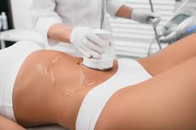 who can benefit from laser liposuction