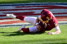 Like the cleveland browns, they could be the second team with their owner's name as the team name. Kyle Allen Suffers Gruesome Leg Injury In Washington Vs Giants