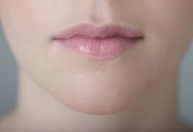 was ist lippenherpes und wie entsteht es