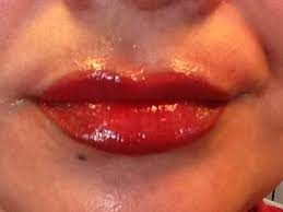 lips before and after photos wakeup