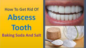 are tooth abscesses treatable with