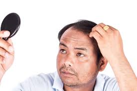 This includes artas hair transplant costs and prices, how long will at its simplest, artas takes follicular unit extraction (fue) method of hair transplantation to the next level. Blog My Hair Transplant Md