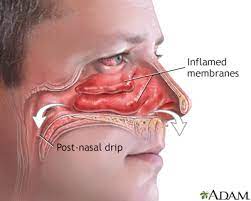 stuffy or runny nose