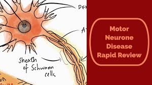 motor neurone disease aka als lou
