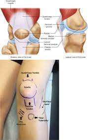 anterior knee pain diagnosis and
