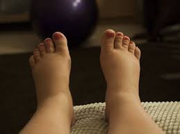 home remes for swelling in feet 10