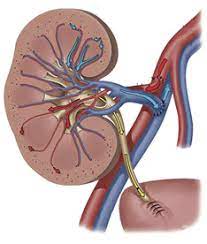 Preemptive kidney transplant